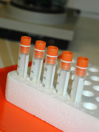 sperm-donor-art-vials